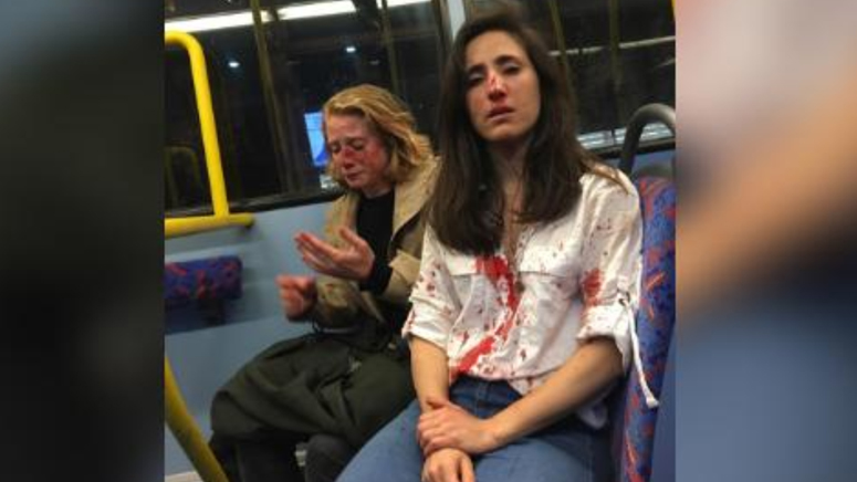 London Police Arrest 5th Suspect In Attack On Lesbian