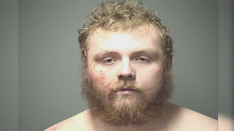 Naked, sweating mans beard catches fire after police 
