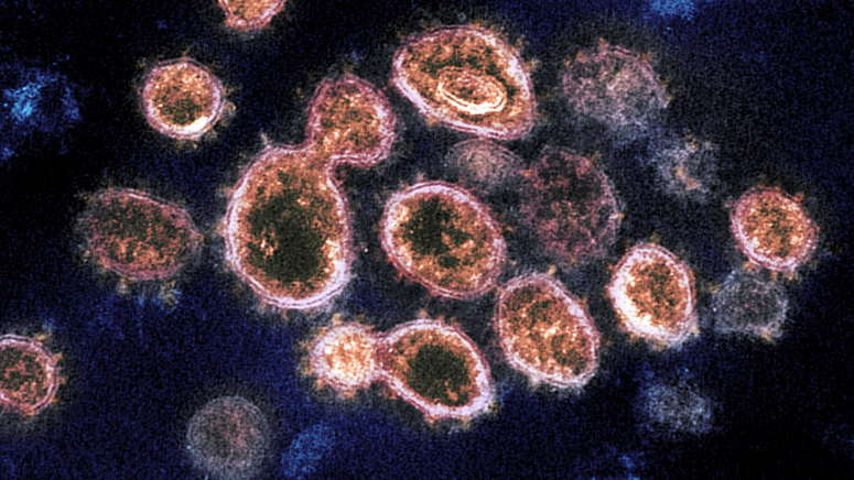 Novel Coronavirus SARS-CoV-2