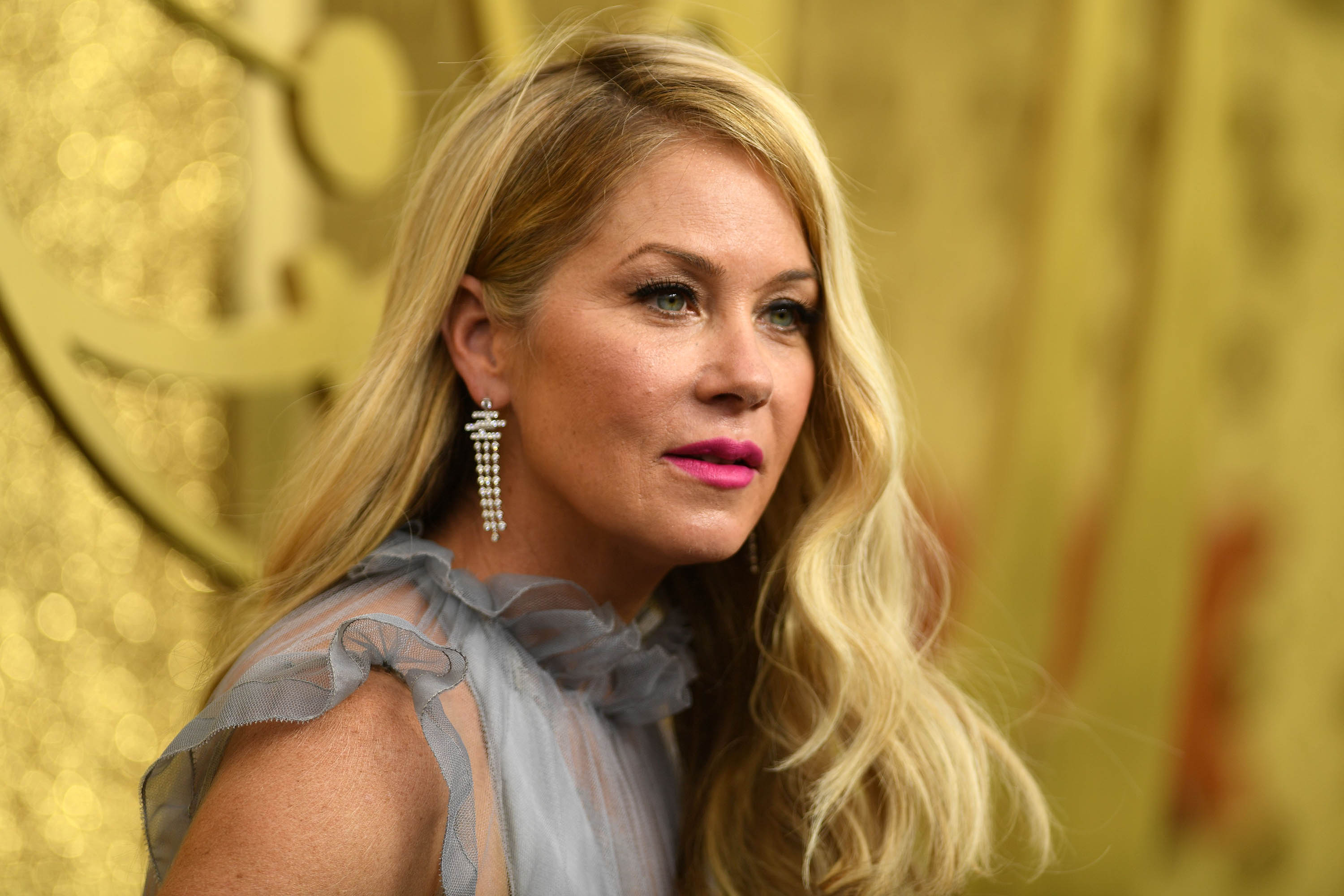 Christina Applegate reveals she has multiple sclerosis Boston News