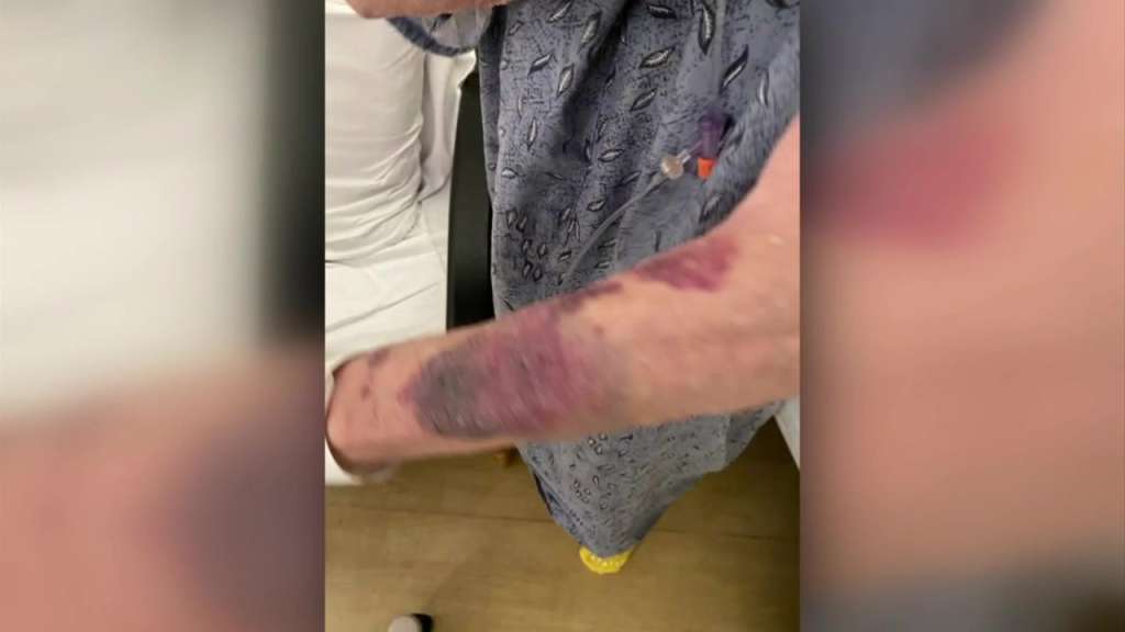 ‘Shame on you’: Daughter of elderly man hospitalized after alleged attack delivers message to those responsible