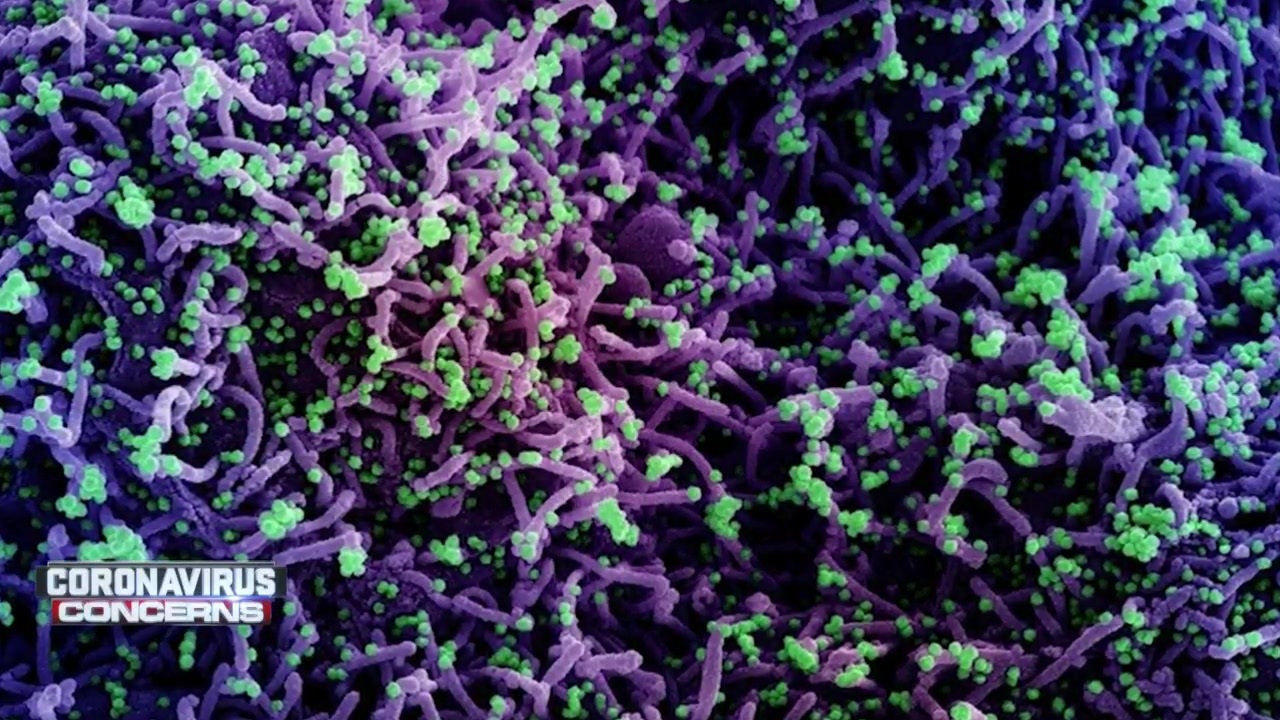 South Africa’s case drop may show omicron peak has passed Boston News