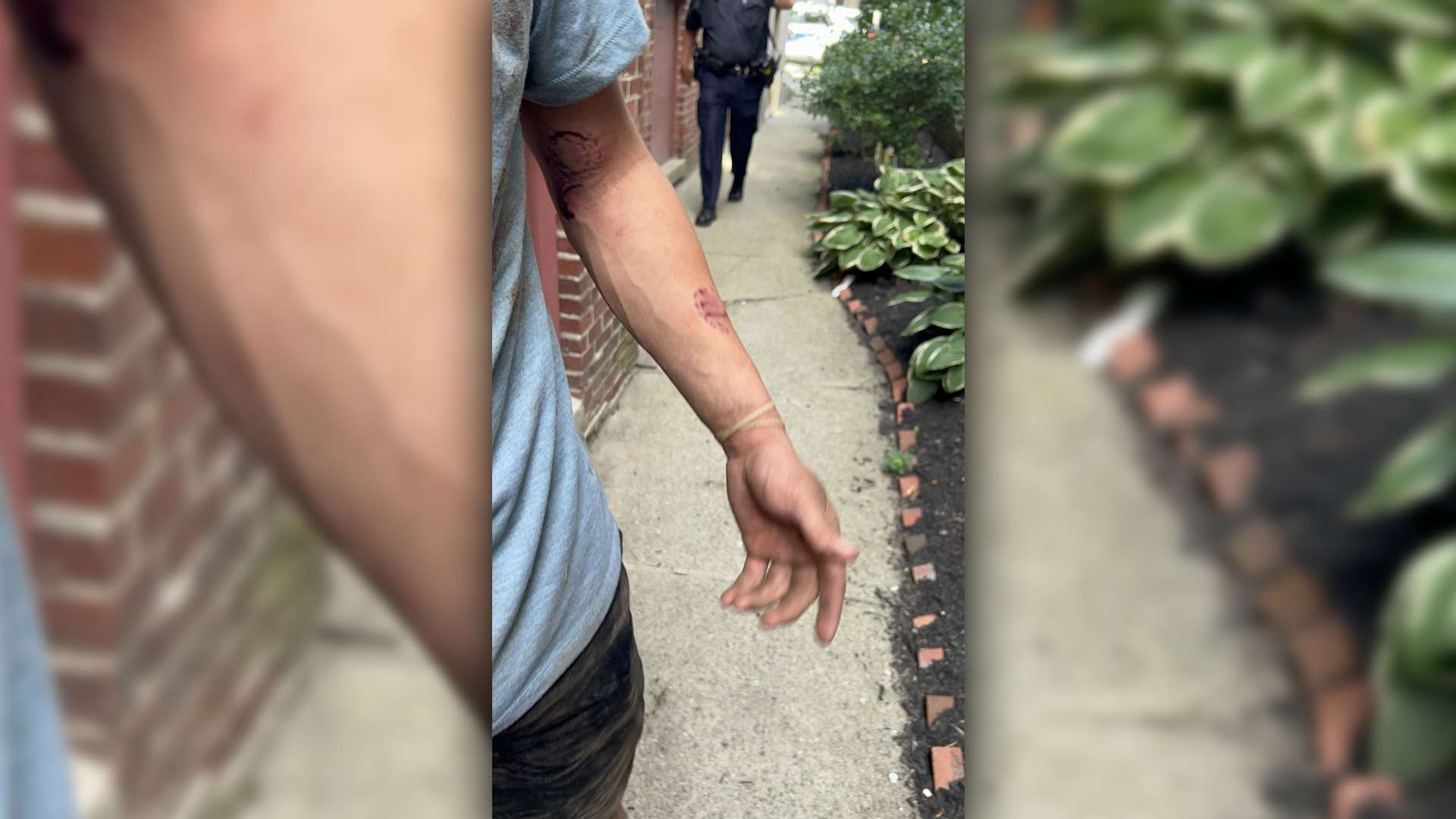Man who bit, stabbed Good Samaritan during robbery attempt appears in ...