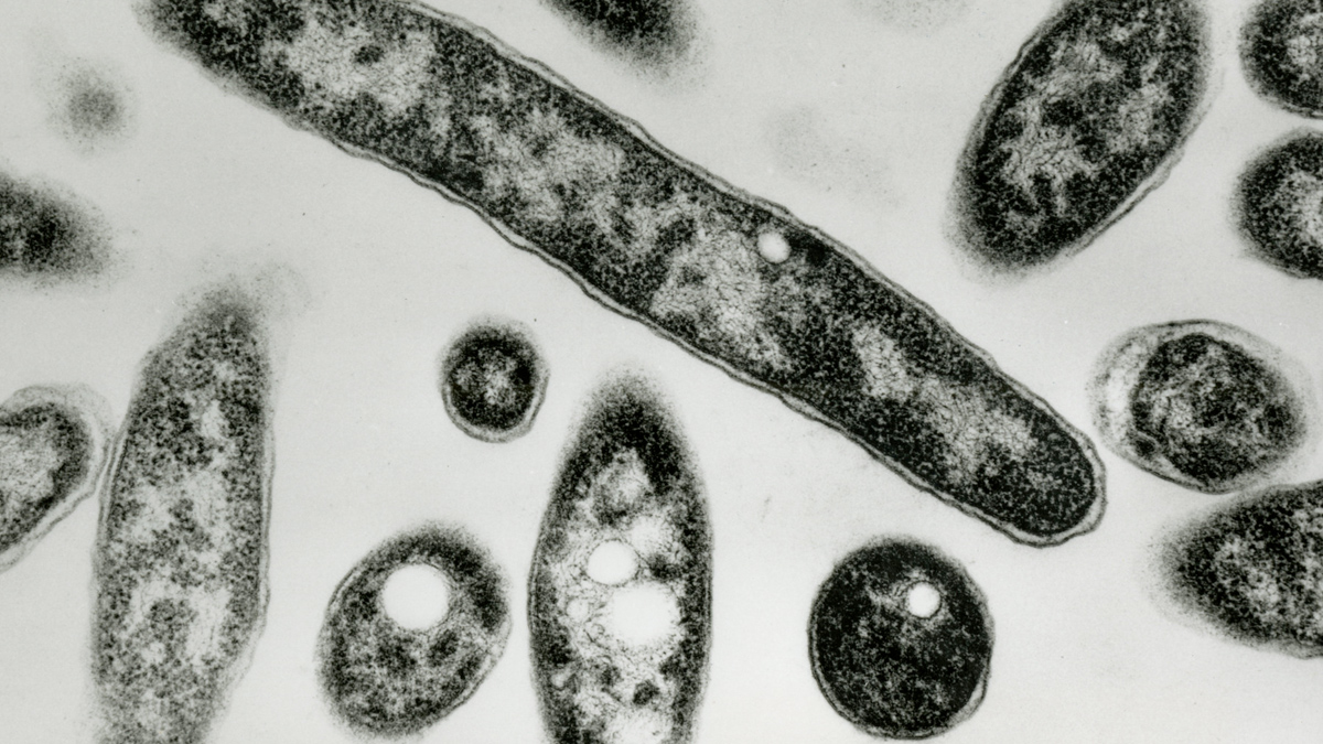 Cause of pneumonia cluster in Argentina identified as legionella