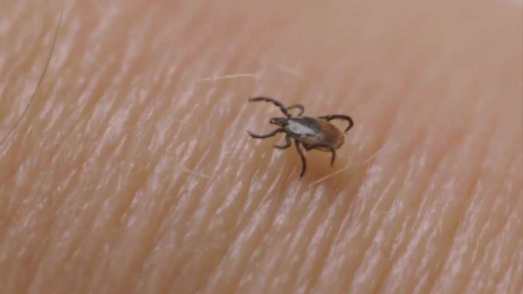 Tick Trouble: How to protect yourself this summer from Lyme disease - Vimarsana News