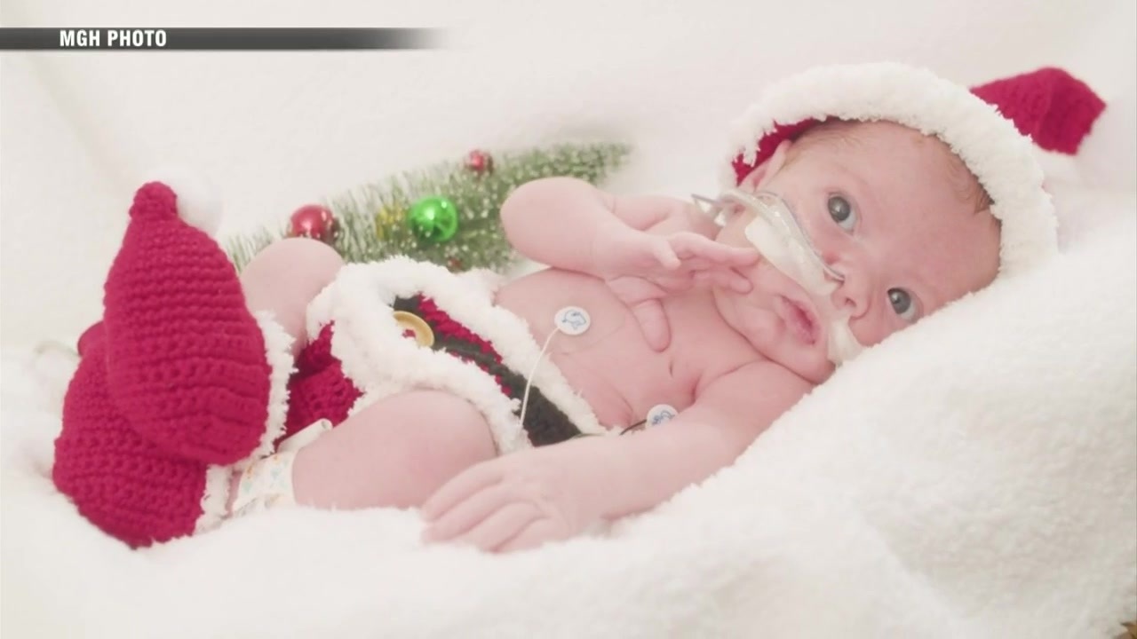 ICU中的新生儿与庆祝第一个圣诞节的照片摄影
