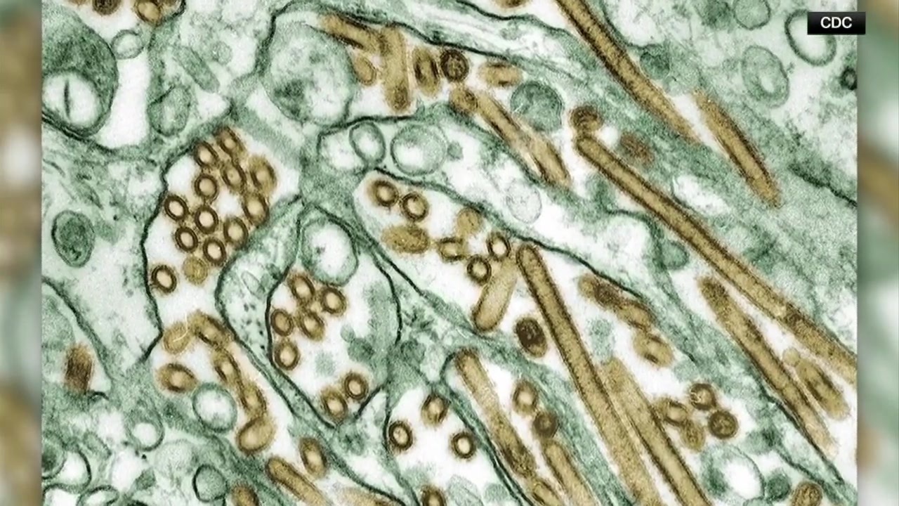 Health officials speak on spread of bird flu in Massachusetts Boston