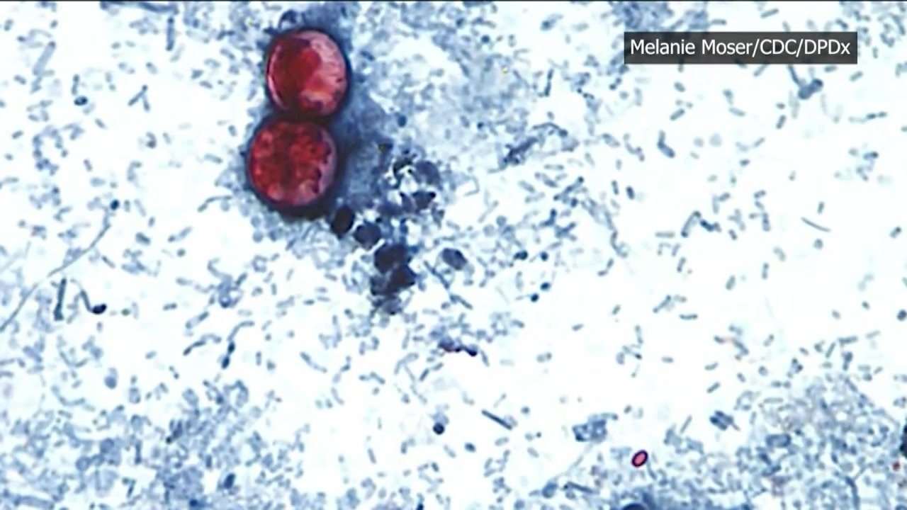 Michigan reports first 2 US deaths in outbreak of cyclospora